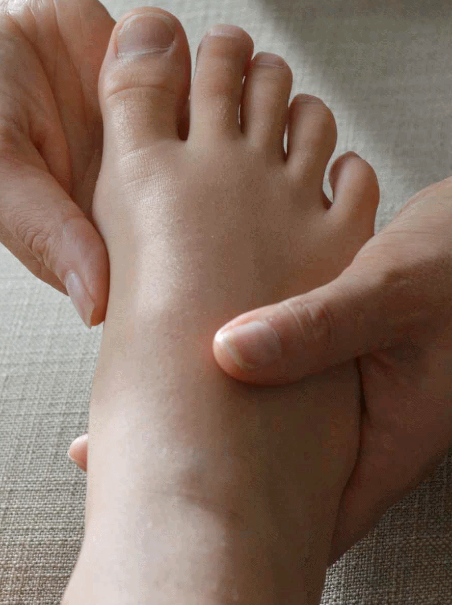 Diabeetikon vuosihuolto, jalkaterapeutti tutki jalkaa